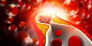 صحتنا في غذائنا.. مزيج خل التفاح والثوم يخفض الكوليسترول- حقيقة أم خرافة؟