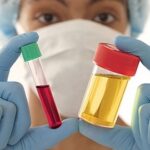 التهاب المثانة.. المشكل الذي تعانيه ملايين النساء