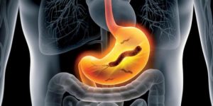 الأسبرين وجرثومة المعدة… علاقة معقدة في التسبب بقروحها