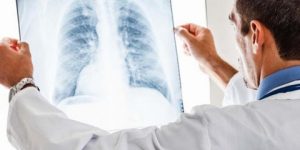 هكذا يحدد لون المخاط الحالات الصحية… بعضها خطير