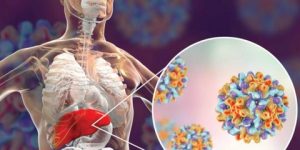 التهاب الكبد الفيروسي «بي»… مراجعة علمية لمستجدات العلاج