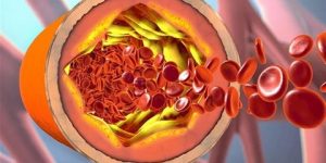 خبراء: انخفاض الكوليسترول الضار بقوة يهدد القلب