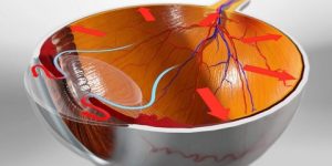 5 أساطير حول الغلوكوما والعمى