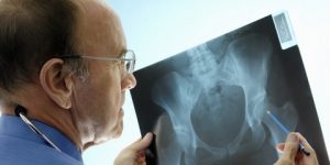 علمياً.. القلق يضعف عظام السيدات