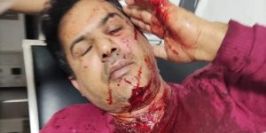 اتحاد المحامين الصحراويين يدين الجريمة التي تعرض لها الناشط  الصحراوي رشيد الصغير