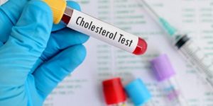 تحليل الكوليسترول- معلومات يجب معرفتها عنه