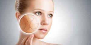 جمال وأناقة.. احمي بشرتك من التشققات بخطوات بسيطة