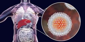 التهاب الكبد “ب” يصيب البشر منذ قرون.. ولم يتطور كثيراً