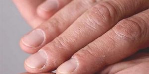 سنريهم آياتنا في الآفاق.. نعمة وجود الأظافر