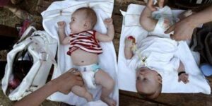 الأعراض والأسباب والعلاج.. فقر دم الأطفال بسبب نقص الحديد