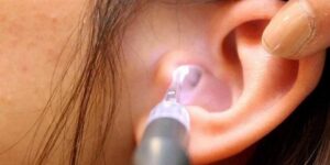 جديد الطب.. التهابات الأذن قد تؤخر الكلام لدى الأطفال