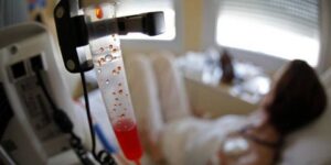 جديد الطب.. عقار جديد يقلل الآثار الجانبية لعلاج سرطان الثدي