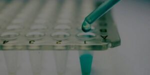 أول مرة في العالم… شفاء مريض سكري باستخدام العلاج بالخلايا