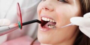 عادات يومية خاطئة تؤدي إليها.. تجنب مشكلات الأسنان في فصل الصيف