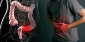 يكون خطيرا في بعض الحالات.. أعراض الإمساك التي ينبغي الانتباه لها