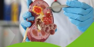 الكبد.. كيف نعرف أنه متضرر؟