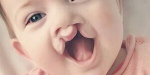 بهدف توفير علاجات جديدة وفعّالة ..باحثون يطورون أول نموذج خلوي ثلاثي الأبعاد للشفاه الأرنبية