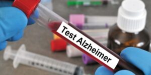 علماء يبتكرون جهاز للكشف المبكر عن الزهايمر