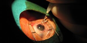 دراسة حديثة تكشف عنها.. فوائد مميزة لحقن الأدوية في شبكية العين