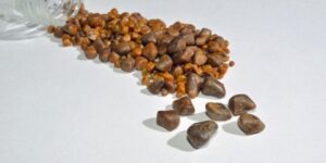 حصوات المرارة.. كيف السبيل لعلاجها؟