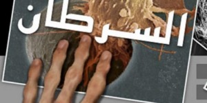 حقائق يجب أن تعلمها.. أبرز الأسئلة الشائعة حول مرض السرطان؟