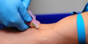 حسب تجربة أولية.. اختبار دم بسيط قد يغير حياة مرضى السرطان