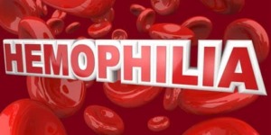 نصائح وتدابير لمرضى الهيموفيليا خلال الصيام