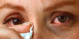 أهم الطرق للوقاية من الرمد الربيعي