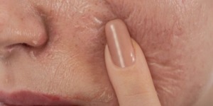 تقشير الجلد.. من أهم خطوات العناية بالبشرة